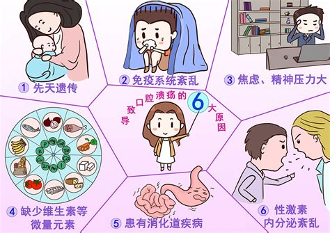 口腔溃疡发病机制